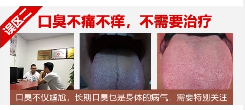 口臭不疼不癢、不需要治療