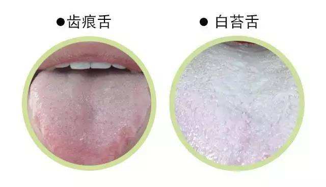 舌苔示意圖