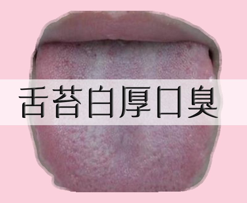 厚膩的舌苔