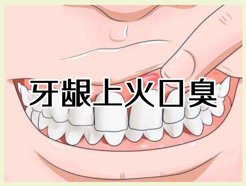 上火的牙齦