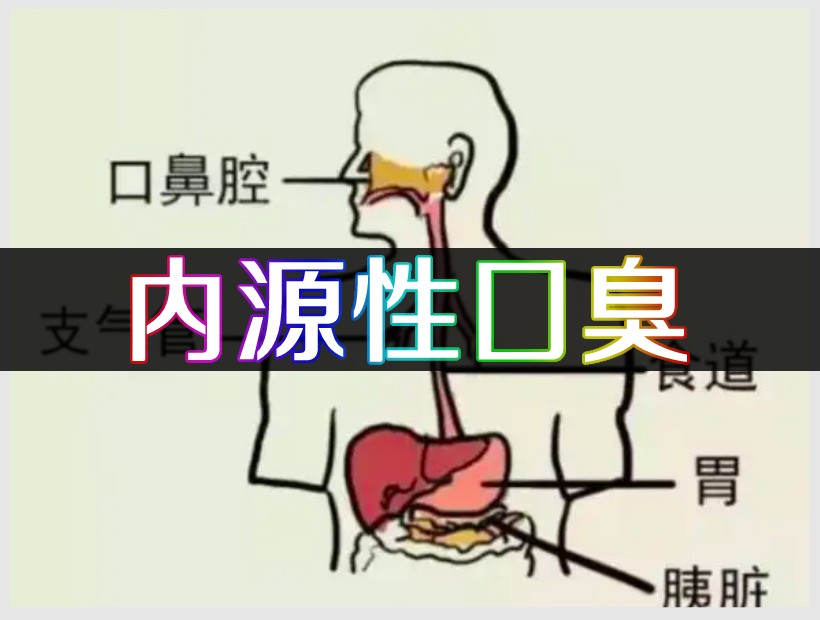 內(nèi)源性口臭示意圖