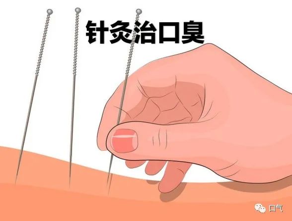 針灸治口臭