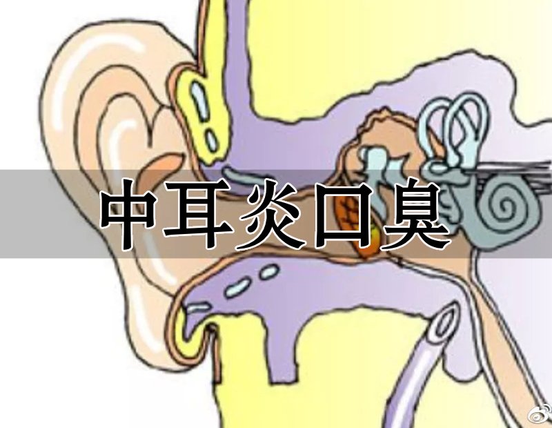 中耳炎口臭結(jié)構(gòu)圖